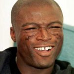 Lupus In The Media: Famous People Living with Lupus